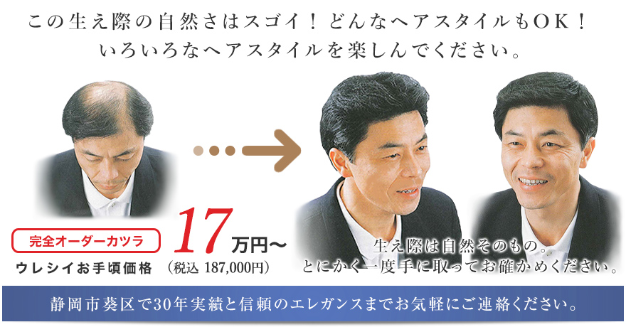 この生え際の自然さはスゴイ！どんなヘアスタイルもOK！いろいろなヘアスタイルを楽しんでください。