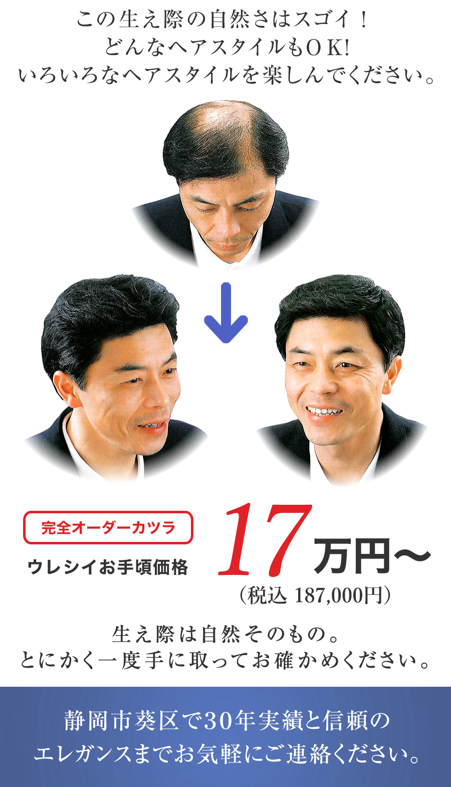 この生え際の自然さはスゴイ！どんなヘアスタイルもOK！いろいろなヘアスタイルを楽しんでください。