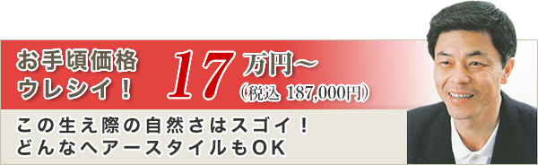 お手頃価格ウレシイ17万円（税込187,000円）この生え際の自然さはスゴイ！！どんなヘアースタイルもOK